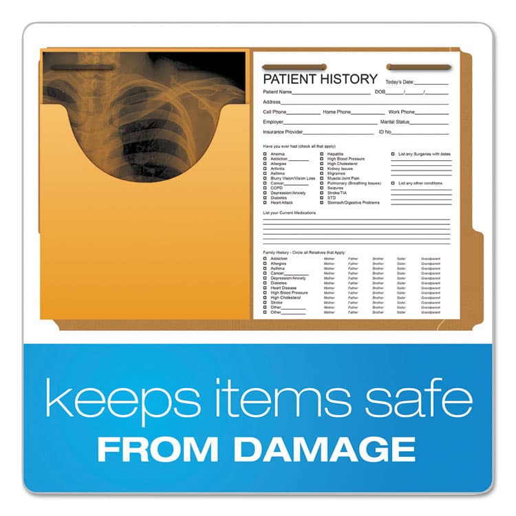 TOPS BUSINESS FORMS Expandable Kraft Retention Jackets, Straight Tab, Letter/Legal Size, Brown, 100/Box (PFXJ044) thumbnail 3