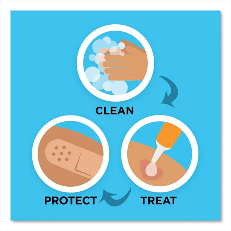 JOHNSON & JOHNSON Antibiotic Adhesive Bandages, Assorted Sizes, 20/Box (JOJ5570) thumbnail 3